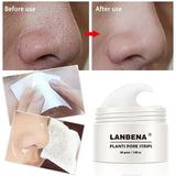 Blackhead Remover Cream