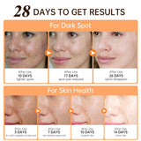 Vitamin C Whitening Cream Dark Spot Remover