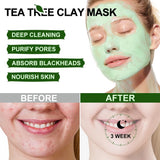 Acne Treatment Facial Mask