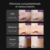 Bamboo Charcoal Blackhead Remover