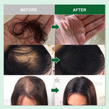 Rosemary Oil Hair Growth